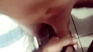 foreskin