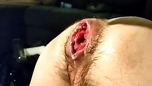 Just fisting my bad hole together with prolapse:)